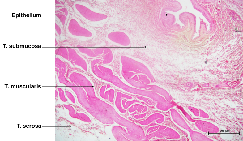 Bladder 2